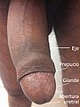 A flaccid penis Spanish.jpg