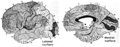 Brodmann map of human brain