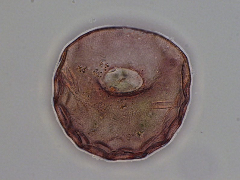 File:Collection Penard MHNG Specimen 69-5-5 Arcella vulgaris.tif