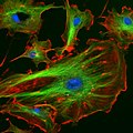 Cellule endoteliali al microscopio a fluorescenza. I nuclei sono evidenziati in blu con il DAPI, i microtubuli in verde con un anticorpo legato al FITC e i filamenti di actina sono marcati in rosso mediante falloidina coniugata al TRITC. Cellule da arteria polmonare bovina.