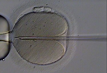 Intracytoplasmic sperm injection of a human oocyte ICSI.jpg