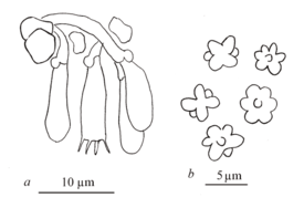Kätköhidun mikroskooppisia piirteitä: a – itiökantoja; b – itiöitä.