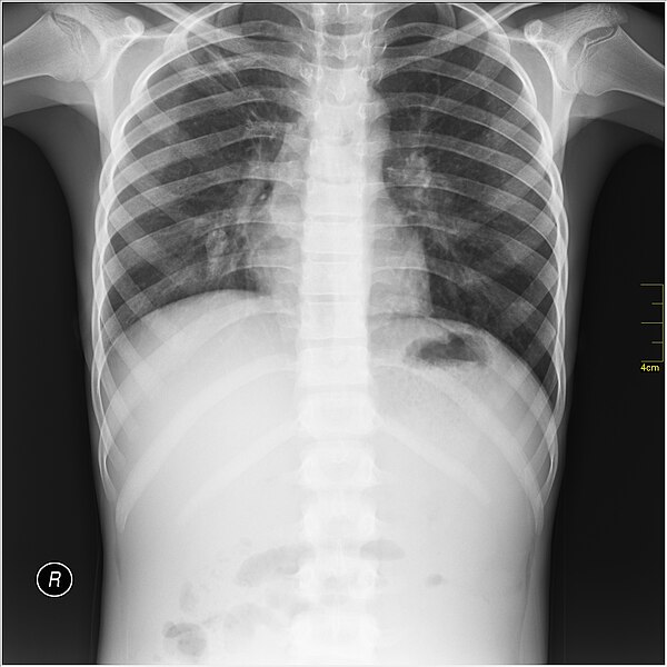File:Medical X-Ray imaging XJI07 nevit.jpg
