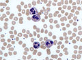 Imatge presa amb un microscopi òptic on s'observen neutròfils envoltats de glòbuls vermells en un frotis sanguini.