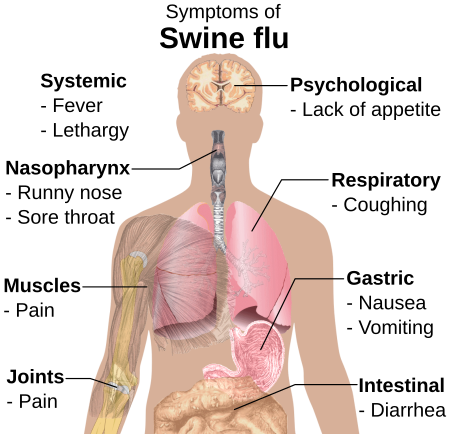 ไฟล์:Symptoms of swine flu.svg