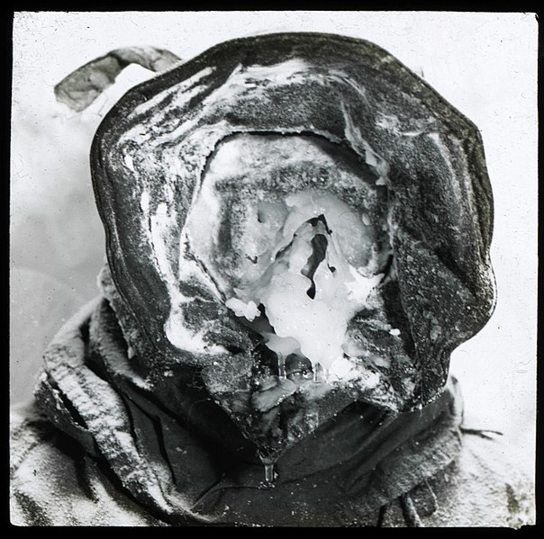 File:The meteorologist with an ice-mask (Australasian Antarctic Expedition, 1911-1914) (6173948894).jpg