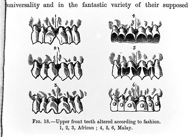 File:Upper front teeth altered to fashion; African and Malay Wellcome M0005586.jpg