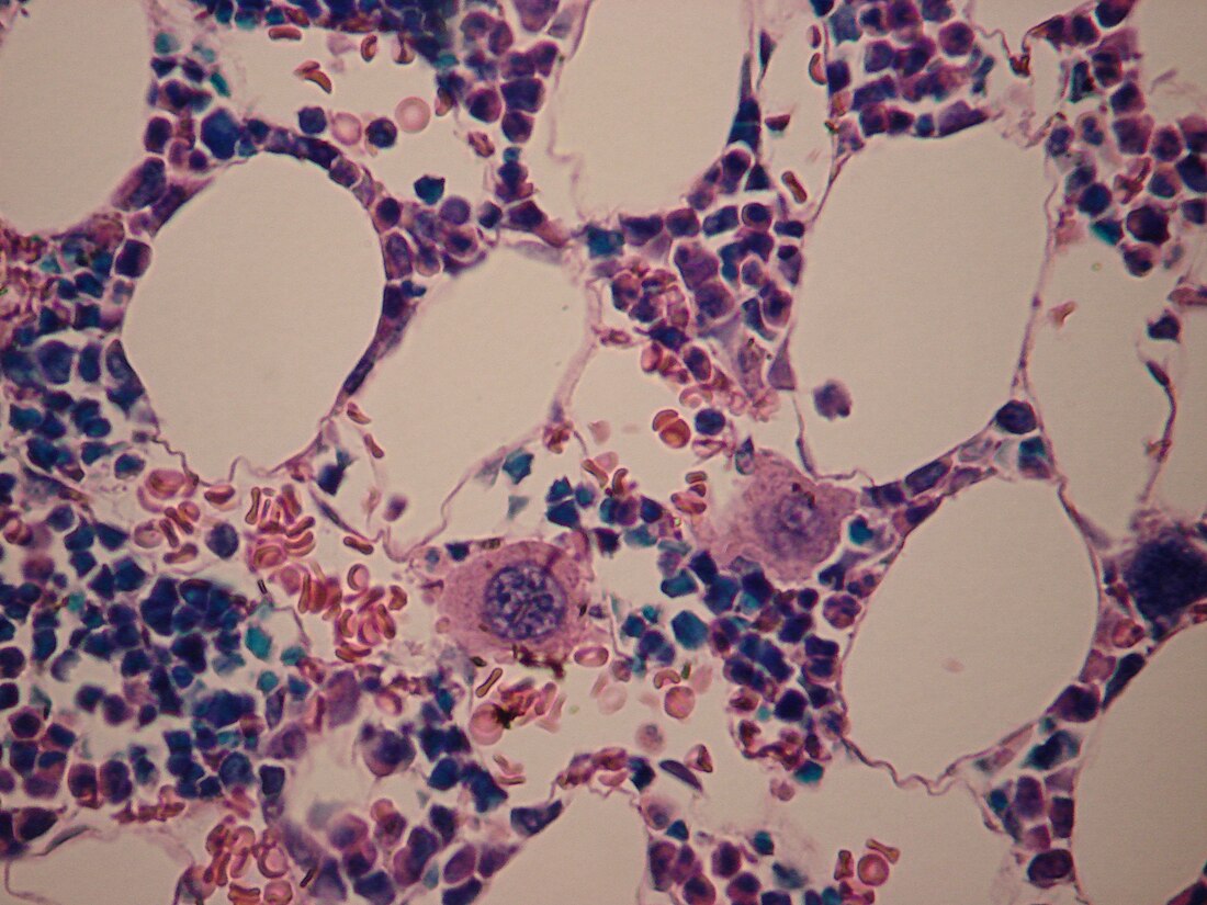 File:WVSOM Megakaryocytes.JPG