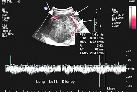 Echografie sectie in zwart-wit.