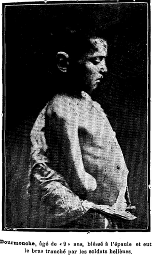 Durmus ("Dourmouche"), a boy wounded and hand cut off during the Yalova peninsula massacres. Dourmouche, a boy wounded and hand cut off..png