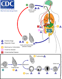 giardia signs in humans