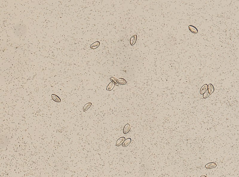 File:Enterobius vermicularis (YPM IZ 095271).jpeg