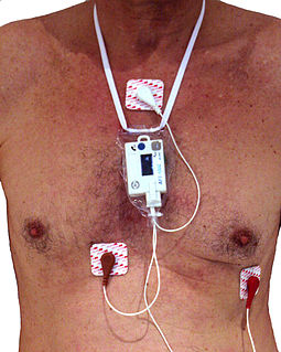 <span class="mw-page-title-main">Holter monitor</span> Portable device for cardiac monitoring