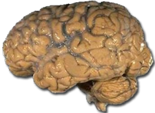 Human brain NIH.png