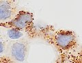 Cytoplasmic staining
