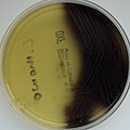 Listeria monocytogenes - Oxford Listeria Agar2.jpg