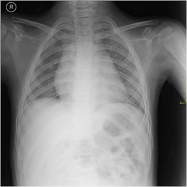 File:Medical X-Ray imaging SOU07 nevit.jpg