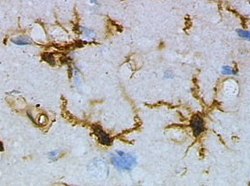 Photo of Microglia