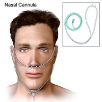Nasal Cannula (Adult).png