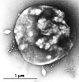 Sulfolobus（古細菌）不定型球菌。表面にウイルスが付着している