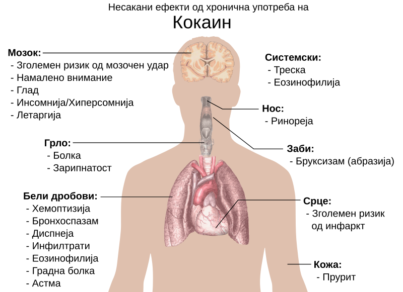 File:Side effects of chronic use of Cocaine mk.svg