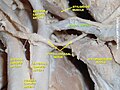 Dissection du cou montrant l'artère faciale. Vue de profil.