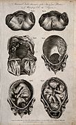 Category:Female anatomy - Wikimedia Commons