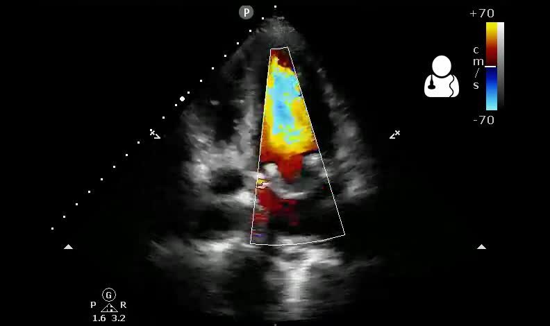 File:UOTW 27 - Ultrasound of the Week 3.webm