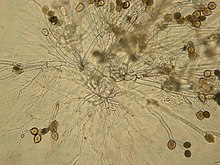 Zoomed out view of a mature thallus of Allomyces strain WJD103. Note the orange-brown zoosporangia and resting sporangia at the terminals of the branches. WJD103 6-16-11 mature thallus.jpg