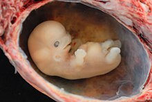 https://upload.wikimedia.org/wikipedia/commons/thumb/0/0b/Human_Embryo_-_Approximately_8_weeks_estimated_gestational_age.jpg/220px-Human_Embryo_-_Approximately_8_weeks_estimated_gestational_age.jpg