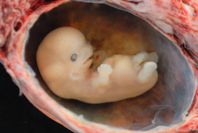 קובץ:Human Embryo - Approximately 8 weeks estimated gestational age.jpg
