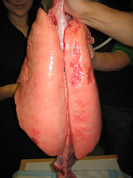 File:Lungs filled with air.jpg