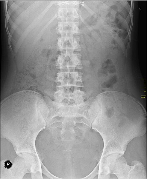 File:Medical X-Ray imaging QOL06 nevit.jpg