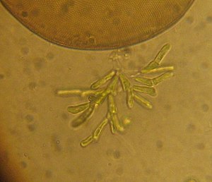 Microthamnion sp.