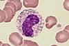 Neutrophil_-_Band_cell-8
