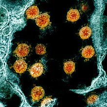 Novel Coronavirus SARS-CoV-2 (49919836657).jpg