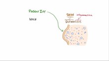 Fil: Type IV hypersensitivity.webm