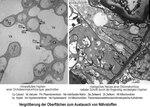 Vignette pour Ectendomycorhize