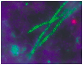 Medlem av släktet Acidobacterium