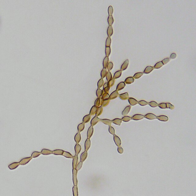 cladosporium herbarum