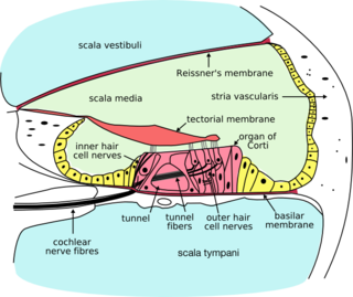 Labyrinthine fistula