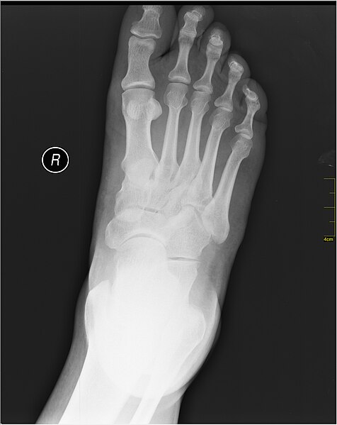 File:Medical X-Ray imaging TGC07 nevit.jpg