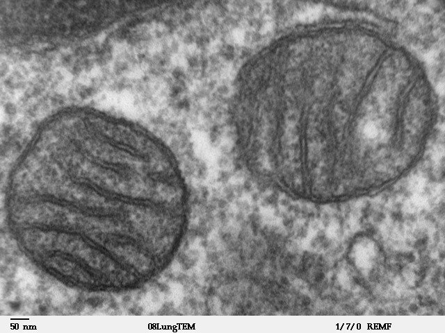 Internal symbiont: mitochondrion has a matrix and membranes, like a free-living alphaproteobacterial cell, from which it may derive.