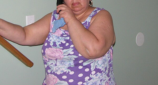 Obese woman