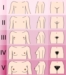 Tanner Stages for Female Sexual Characteristics Tanner scale-female.svg