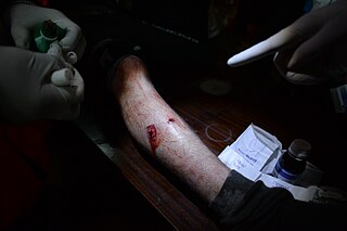 Ukrainian Red Cross Society volunteers administering first aid to a wounded Euromaidan protester. Events of Jan 19, 2014-8.jpg