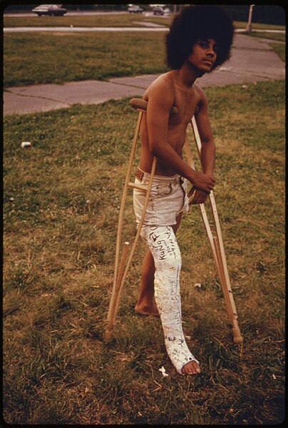File:YOUNG MAN WITH HIS LEG IN A CAST IN HILAND PARK OF BROOKLYN NEW YORK CITY. THE INNER CITY TODAY IS AN ABSOLUTE... - NARA - 555914.jpg