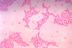 Thumbnail for Bacteroides thetaiotaomicron