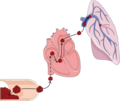 Pulmonary embolism