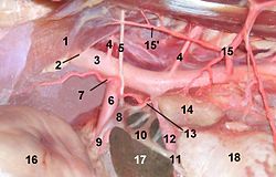 aortic hiatus model